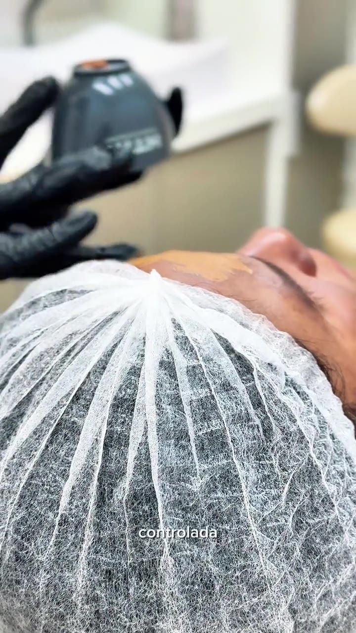 Peeling Químico - vídeo - Cesof